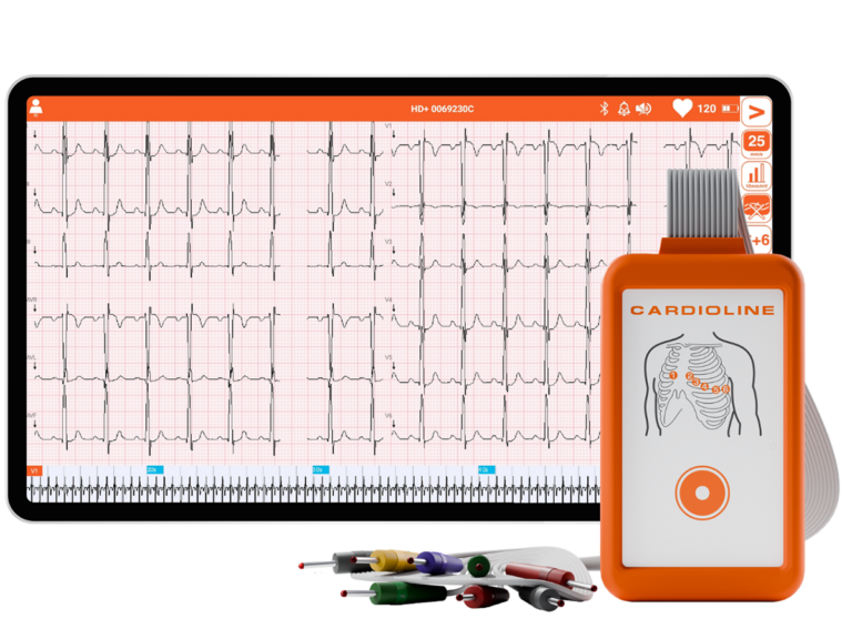 Cardioline touchECG Android