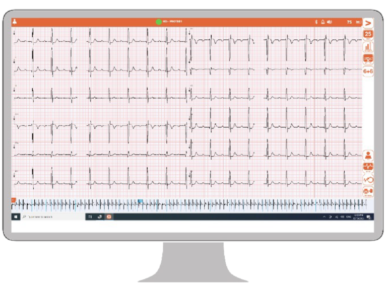 Cardioline touchECG Windows / HD+